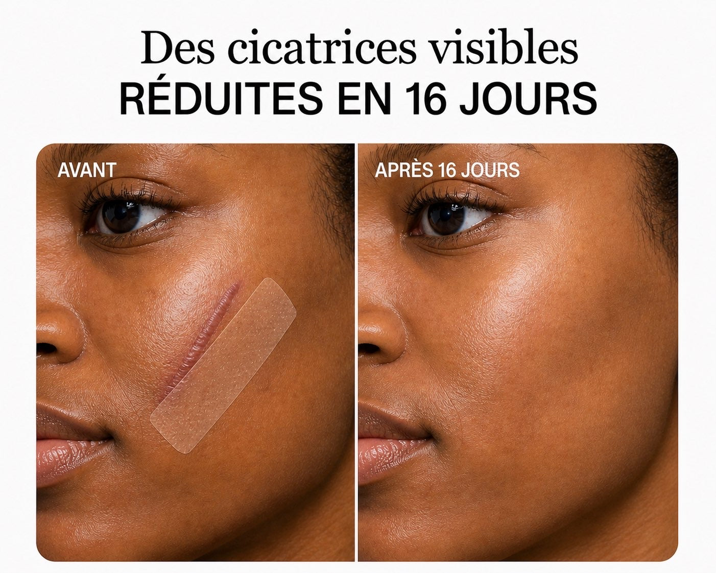 Rouleau bandes cicatrisantes