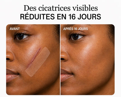 Rouleau bandes cicatrisantes