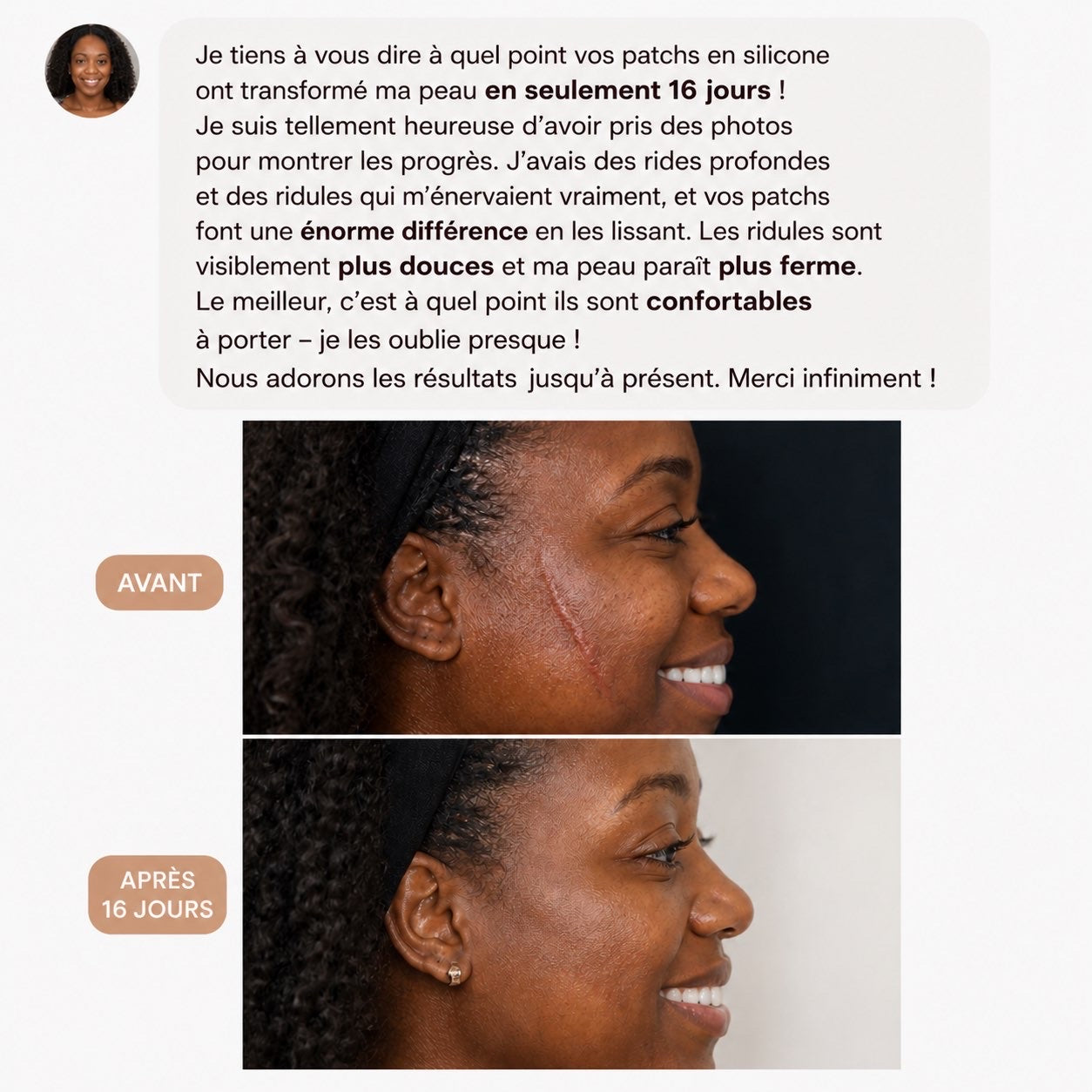 Rouleau bandes cicatrisantes